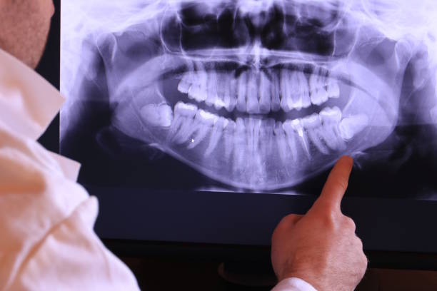 Best Dentist for Severe Toothache  in Chestnut Ridge, NY